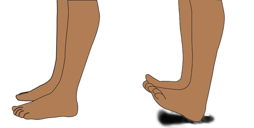 toe taps exercise for shin splints